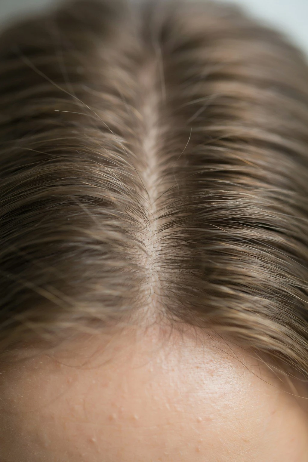 Close-up of a healthy scalp part showing hair at different visible lengths and stages